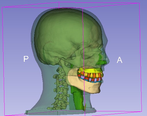 Simulador de cabeça e pescoço desenvolvido pelo professor Matheus Savi